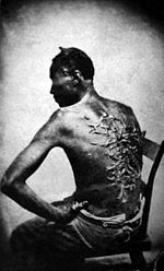 Een zwarte slaaf die erg mishandeld werd. De persoon die hem sloeg werkte voor zijn eigenaar.