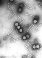 Virus: Gamma bacteriofaag