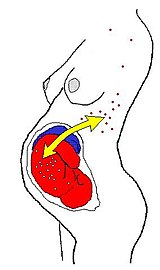Durante a gravidez, pode ocorrer um tráfego bidirecional de células imunes através da placenta. As células trocadas podem se multiplicar e podem ser imunologicamente ativas muito tempo após o nascimento.
