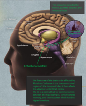 Alcheimera slimība vispirms skar transentorhinālo reģionu, šauru mediālās temporālās daivas zonu, pēc tam tā izplatās uz blakus esošo temporālās daivas zonu - entorhinālo reģionu (jeb entorhinālo garozu).