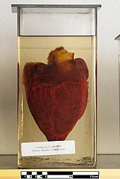 Heart of a horse - clarified preparation for visualization of anatomical structures