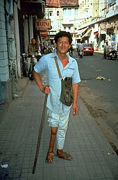 Man with atrophied leg due to poliomyelitis