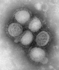 Elektronenmicroscoopbeeld van het N1H1-virus. De virussen zijn 80-120 nanometer in diameter.