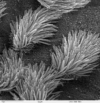 Dit zijn de kleine haartjes, cilia genaamd, die de binnenkant van de luchtwegen bekleden.  