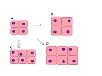 Normale cellen (A), Hypertrofie (B), Hyperplasie (C) en combinatie (D).