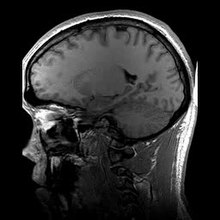 Play media file MRI image of a human head in sagittal section plane
