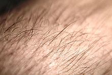 Een foto van haren op een menselijke arm, met elke haar in een haarzakje.