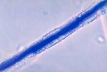 Aspergillus flavus, een soort schimmel, produceert aflatoxine B1, dat kankerverwekkend is.  