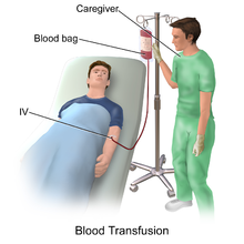 Bloedtransfusies kunnen mensen met denguekoorts helpen