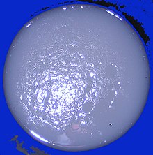 Koleran aikana esiintyvä ripuli näyttää usein "riisivedeltä".  