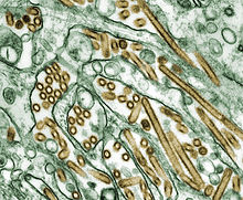 Electron micrograph of A/H5N1 (virus is stained golden)