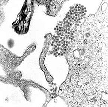 Het denguevirus (de cluster van donkere stippen in het midden) onder een elektronenmicroscoop
