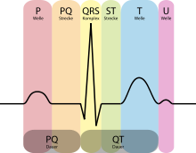 Schematic representation of an ECG with designations