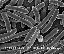 Escherichia coli je mikroskopický jednobuněčný organismus a zároveň prokaryot.