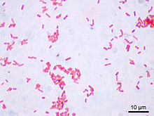 E. coli in the Gram stain