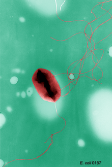 Cell of Escherichia coli with flagella; deformed by preparation; transmission electron microscopy