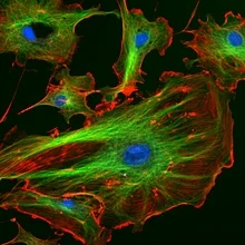 Endotheelcellen onder de microscoop met drie afzonderlijke kanalen die specifieke cellulaire componenten markeren