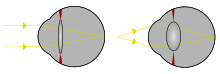 Licht uit één enkel punt van een veraf voorwerp en licht uit één enkel punt van een dichtbij voorwerp dat naar een brandpunt wordt gebracht
