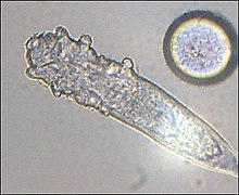 Een microscoop-foto van een Demodex mijt die zich met talg kan voeden.
