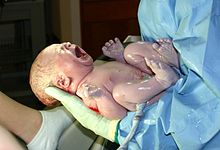 Recién nacido tras un parto típico en un hospital  