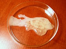 Human sperm in a petri dish