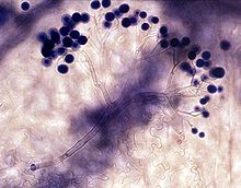 寄生Hyaloperonospora的分生孢子器， 包含几个分生孢子