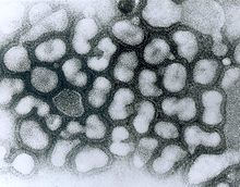 Avian influenza virus (HPAIV), electron micrograph