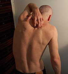 A man scratches his back