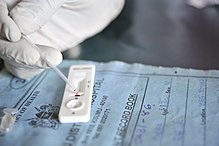 Malaria Rapid Diagnostic Test (RDT) in gebruik in Kenia. RDT duurt ongeveer 20 minuten om een malariadiagnose te stellen. Het is nuttig in gebieden waar geen laboratoriumtests beschikbaar zijn, maar het is niet waterdicht.  
