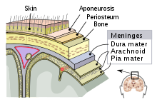 A maioria das hemorragias cerebrais acontece nas meninges. Estas são as três camadas das meninges: a pia, o aracnoide e a dura-máter.