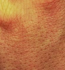 Close-up of human skin (here field skin) . 
