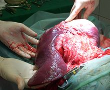 Hemangiosarcoma of the spleen of a dog, surgical site