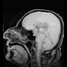 Ezek a képek egy MRI-ről mutatják a liquor mozgását az agyban.