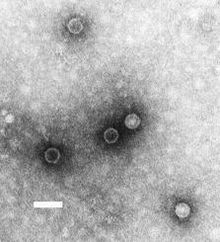 Poliovirus under the electron microscope