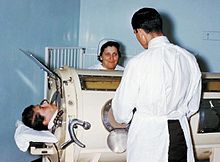 Un hombre enfermo de polio dentro de un ventilador de presión negativa en 1960.  