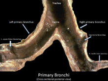 Dit is een dwarsdoorsnede van de primaire bronchiën (één bronchus, twee bronchiën) die de binnenkant van de luchtwegen laat zien. Het is een achteraanzicht, wat betekent dat u van achteren kijkt.  