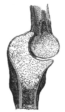 Hinge joint (elbow)