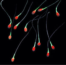 人間の精子の写真。精子の色は実際には赤や緑ではなく、精子をよりはっきりと際立たせるために写真に色を加えたものです。
