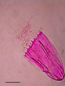 Image de microscopie optique de l'espèce non décrite de Spinoloricus qui vit dans des environnements anoxiques (colorée au Rose Bengale). La barre d'échelle est 50μm.