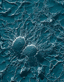 Staphylococcus aureus, zvětšení x50 000, snímek z transmisního elektronového mikroskopu