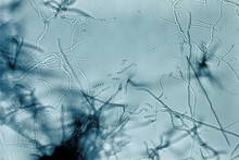 Streptomyces-lajin diapositiiviljelmä  