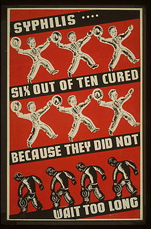 Сифилисът е лечим плакат на Администрацията за работнически прогрес през 30-те и 40-те години на миналия век, когато за първи път се използва пеницилин за лечение на сифилис  