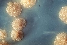 Bir M. tuberculosis kültürünün yakından görüntüsü. Köpük gibi görünen lekeler bu bakterilerin tipik büyüme şeklidir