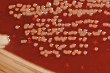 在XLD琼脂平板上生长的肠道耶尔森菌菌落。