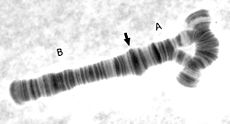 En inversionsslinga i en kromosom  