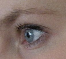 Pupillen og iris ses gennem hornhinden.