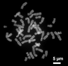 Human chromosomes in late metaphase of mitotic nuclear division: each chromosome shows two chromatids, which are separated and split for two nuclei in anaphase.