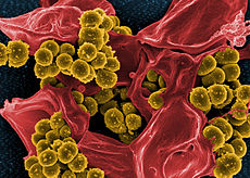 Pásztázó elektronmikroszkópos felvétel meticillin-rezisztens Staphylococcus aureusról és egy elhalt emberi neutrofilről