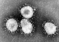Electron micrograph of coronaviruses