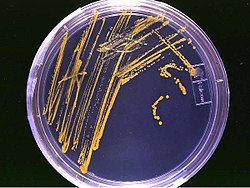 En agarplatta - ett exempel på ett medium för bakterietillväxt. Det är en "streckplatta": de orange linjerna och prickarna är bakteriekolonier.  